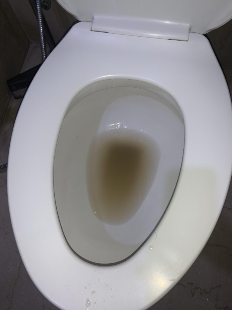 Why is My Toilet Water Dirty