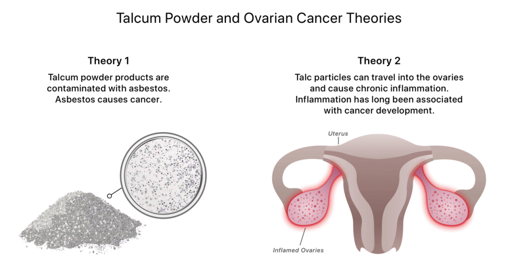 Is Talcum Powder Toxic